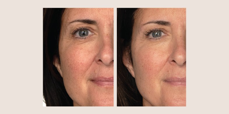 In Article A Tk Step Skincare Routine For Your Decolettage